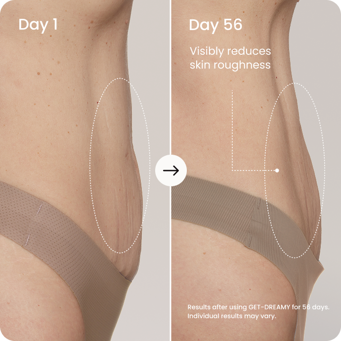 It’s the only clinically proven toning whip In the U.S.